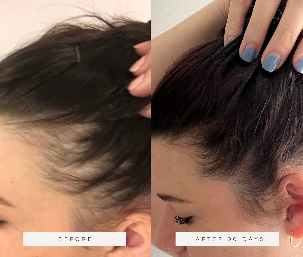 Fast Hair Growth Treatment