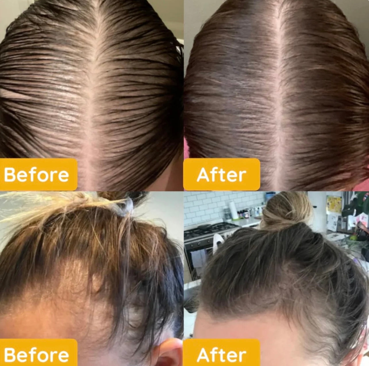 Fast Hair Growth Treatment