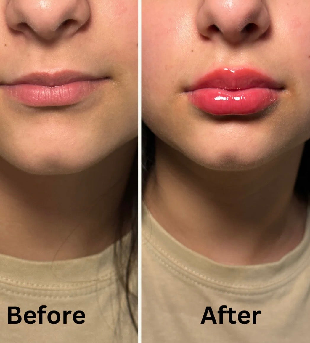 Infinite Beautye - Lip Plumper