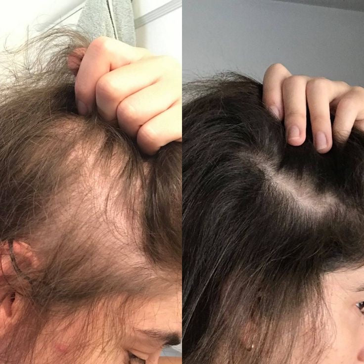 Fast Hair Growth Oil - Infinite Beautye
