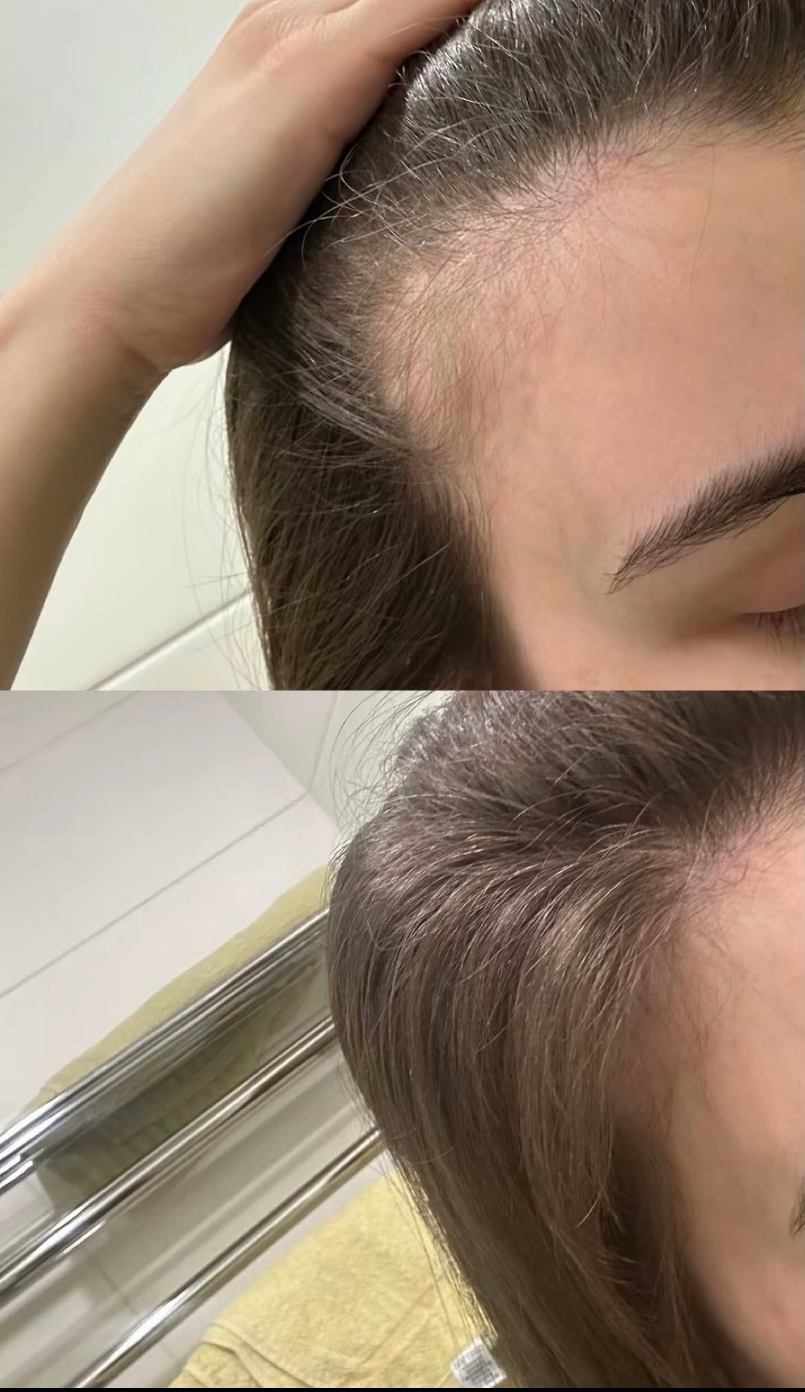Fast Hair Growth Oil - Infinite Beautye